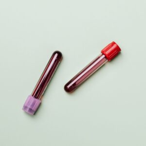 blodprov